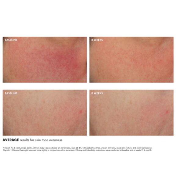 SkinCeuticals Glycolic 10 Renew Overnight 1.7 fl. oz - Picture 3 of 7